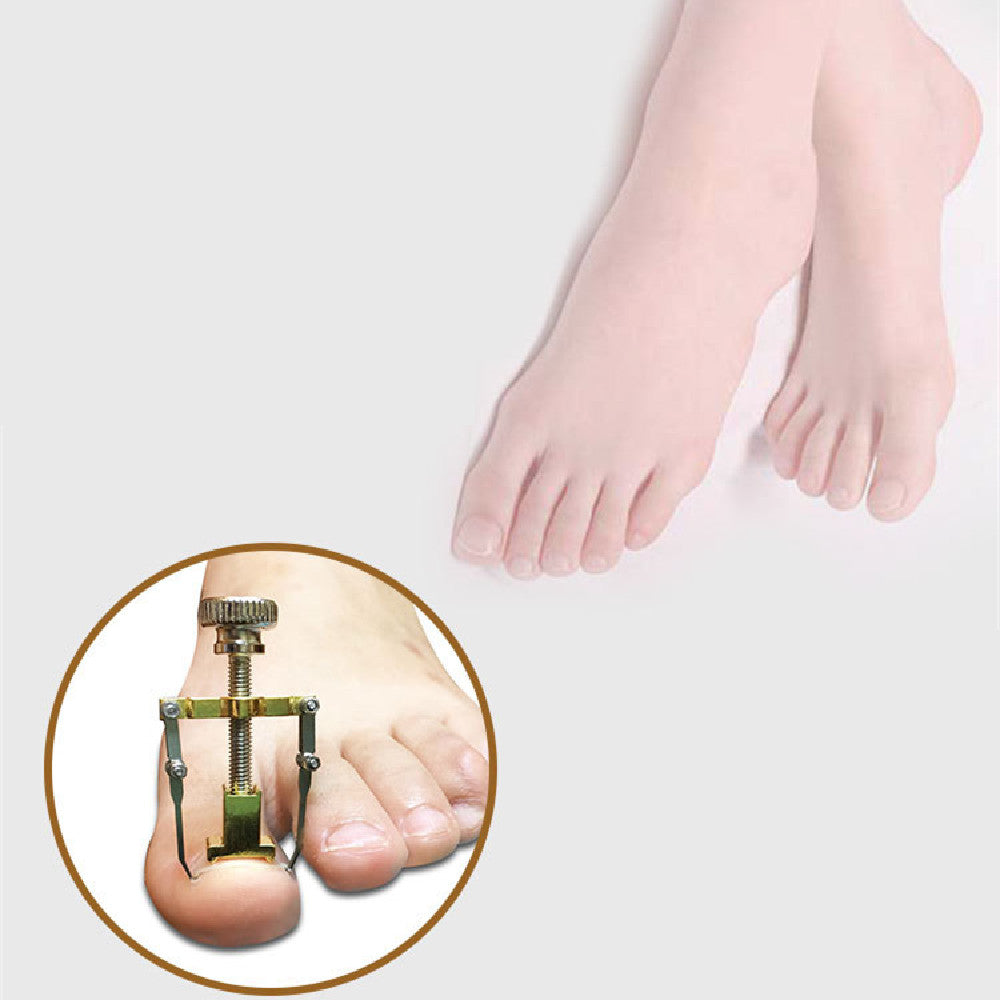 Toenail Physical Straightener for Onyxis Relief