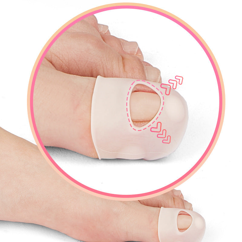 Brighten Skin Nail Corrector Bracket Silicone